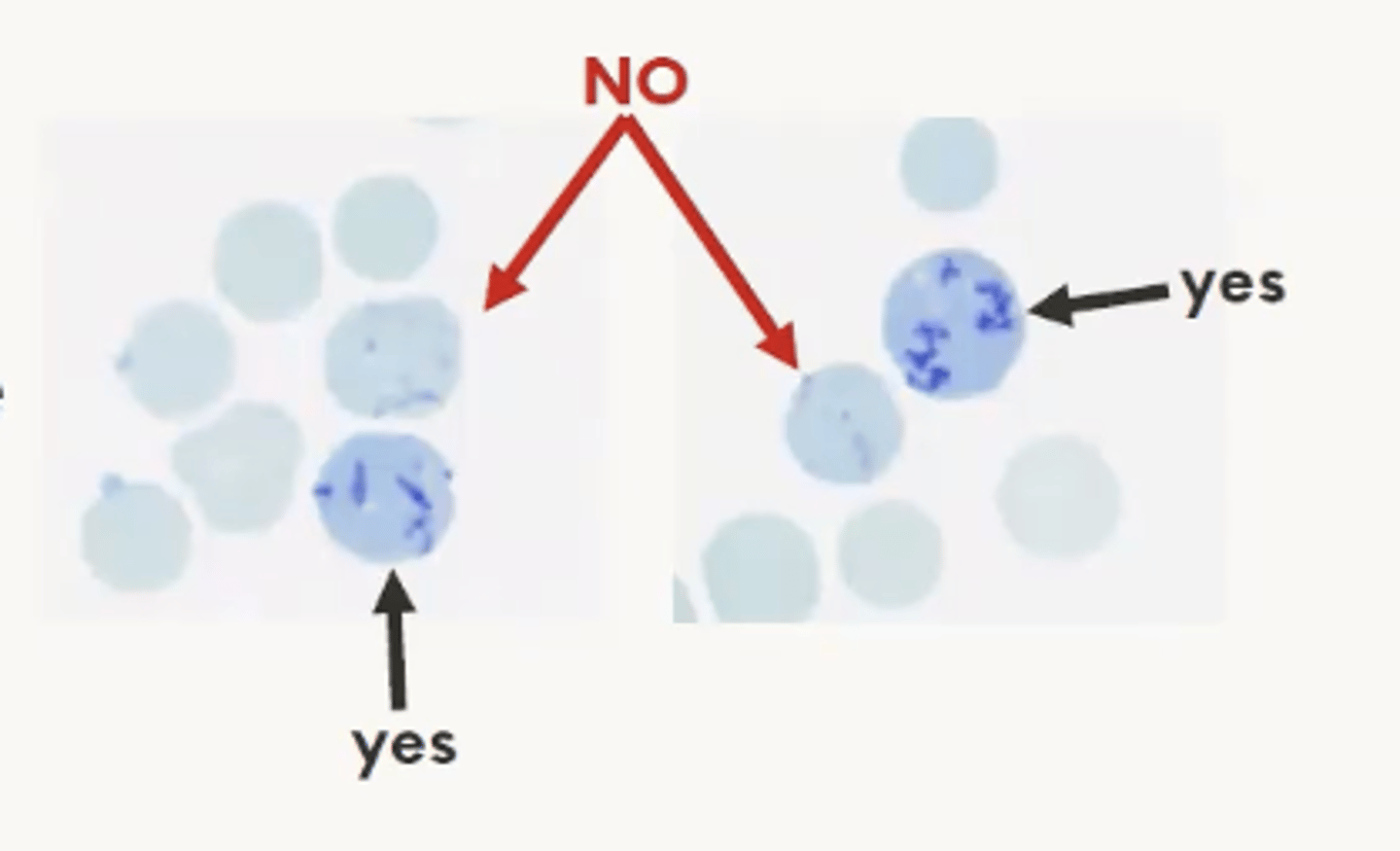 <p>- Only aggregate retculocytes are counted</p>