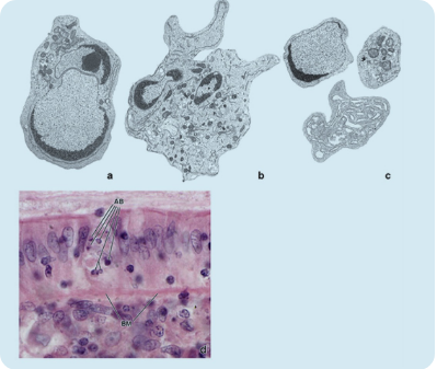 <p>what type of cell death is this? what does AB stand for?</p>