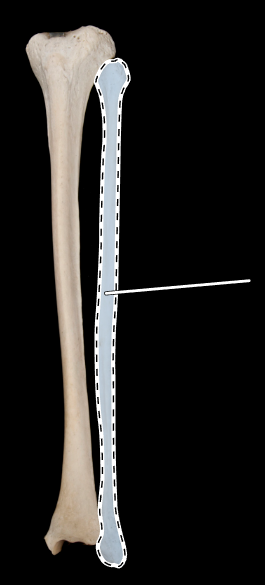 <p>Name this bone.</p><p>(Anterior view).</p>