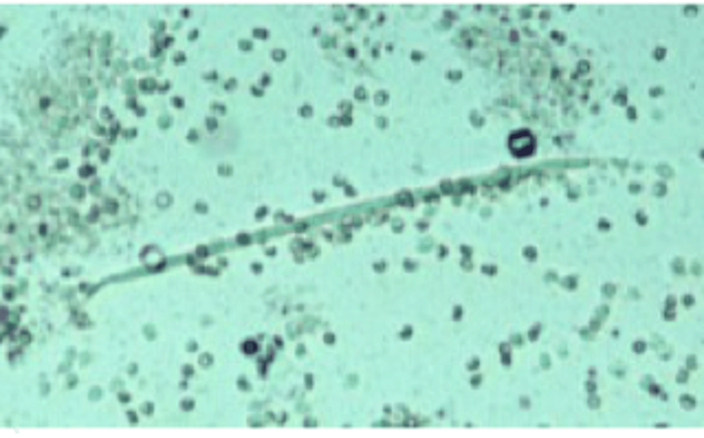 <p>Heartworm</p>