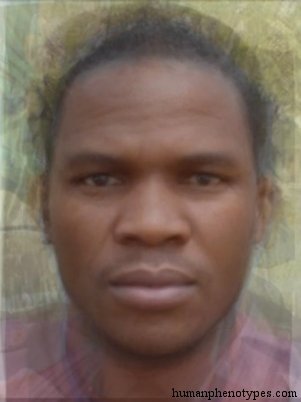 <p>Identify this Phenotype</p>