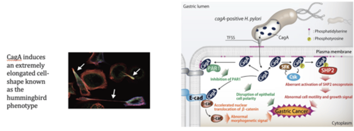 <p>Cag&nbsp;pathogenicity island and gastric adenocarcinoma:</p>