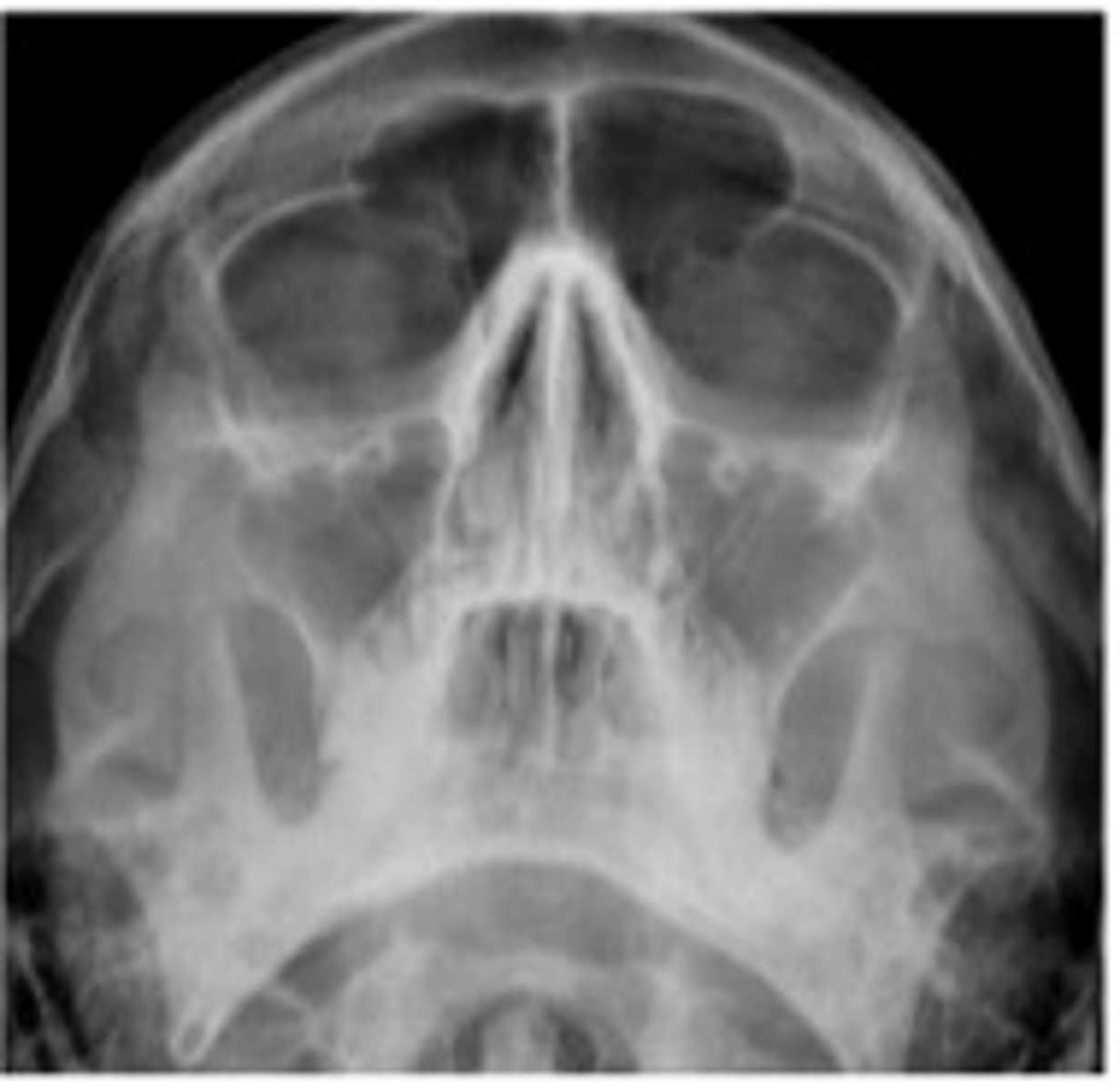 <p>What position/projection? (not sinuses) </p>