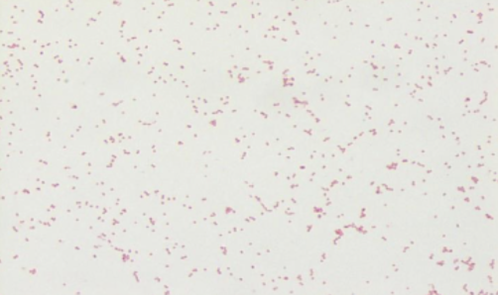 <p>What stain and what does it say about the bacteria?</p>