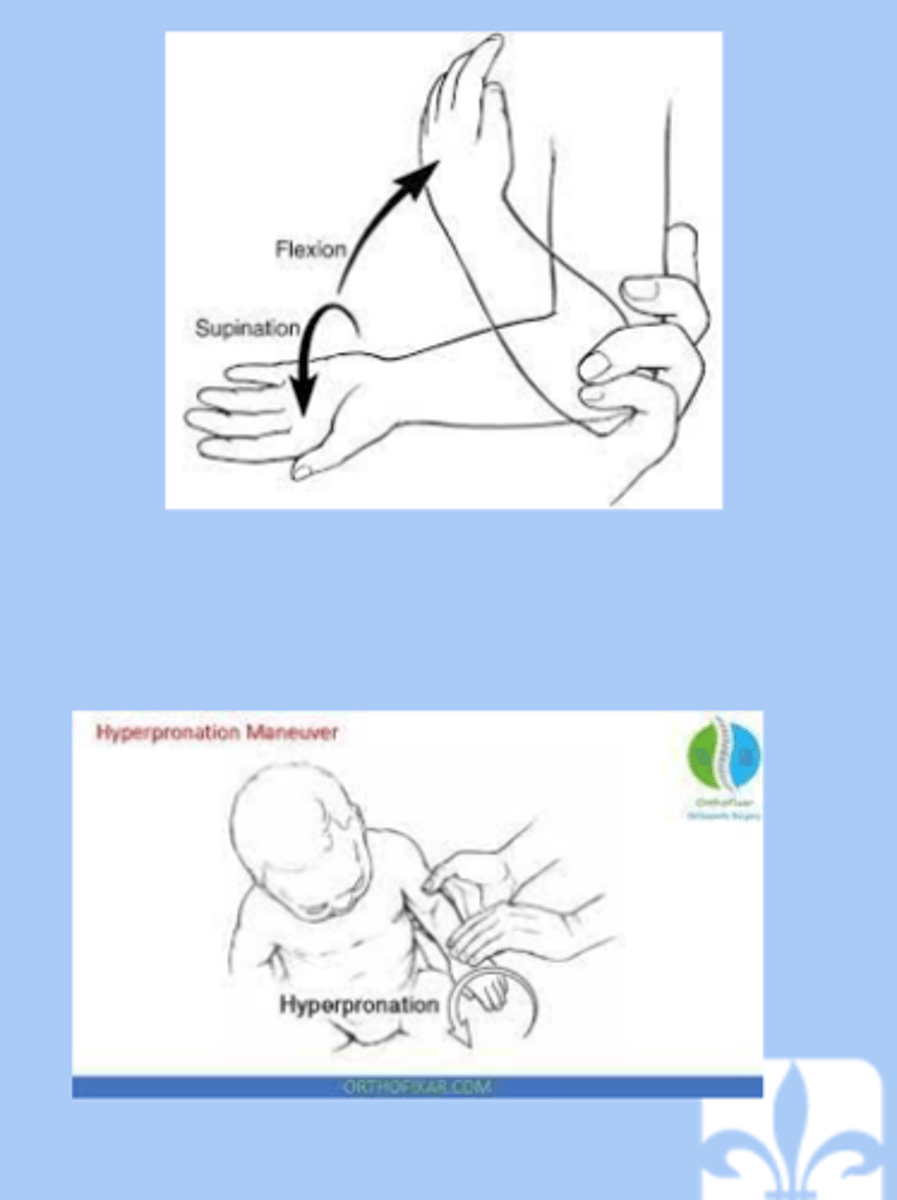 <p>-subluxation of the radial head resulting in trapping of the annular ligament </p><p>-lifted or pulled by the hand </p><p>-sx: child will not bend elbow, pain, not reach for things</p><p>-dx: radiograph= normal, point tenderness over the radial head </p><p>-tx: placing elbow in full supination and slowly moving the arm from full extension to flexion or hold elbow at 90 angle of flexion then slowly hyperpronated the wrist to complete reduction </p>