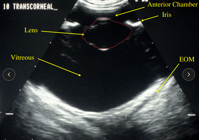 <p><span style="background-color: transparent;"><strong><span>Anterior and Posterior Eye Visualization</span></strong></span></p>