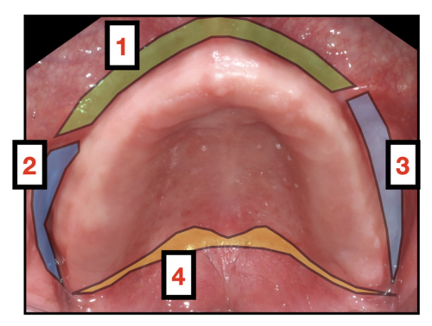 <p>1- Labial vestibule</p><p>2- Buccal vestibule (one side then the other)</p><p>3- Posterior Palatal seal</p>
