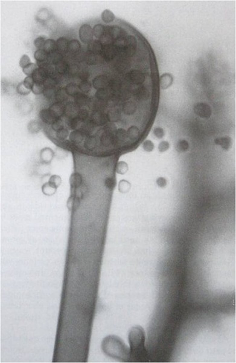 <p>Spore-producing structure in fungus</p>