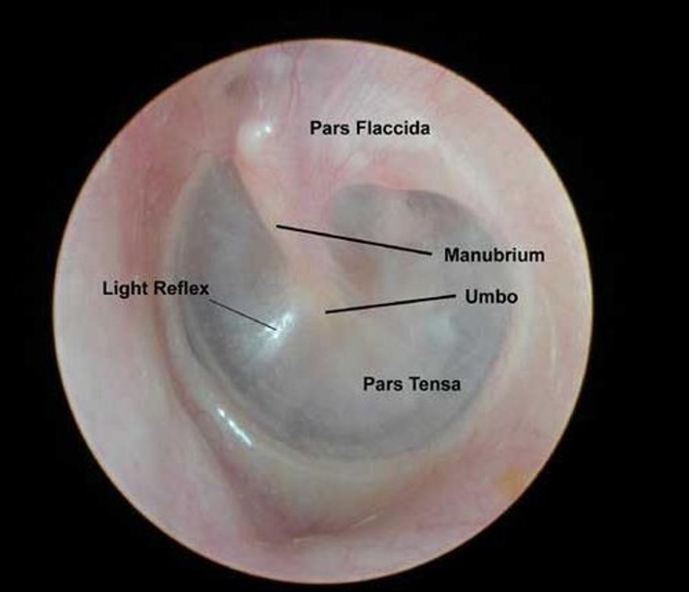 <p>Barrier between outer ear and middle ear; concave disk and very thin.</p>