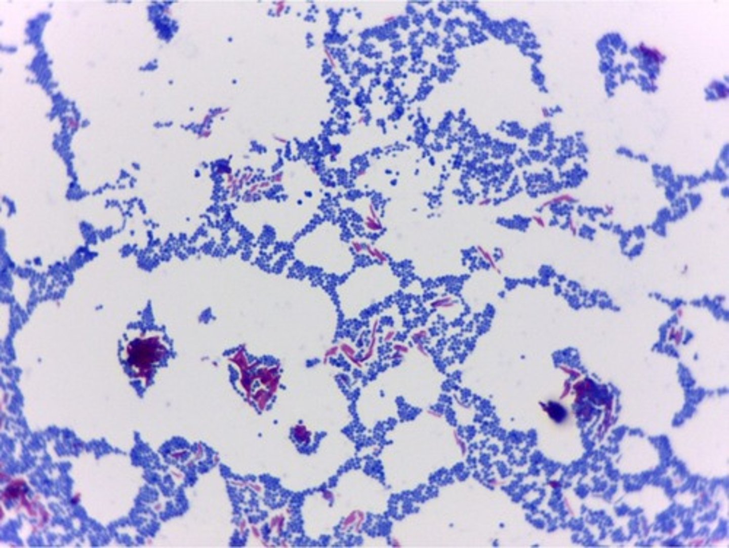 <p>what type of stain is this?</p>