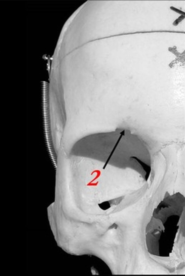 <p>What is #2 pointing to?</p>