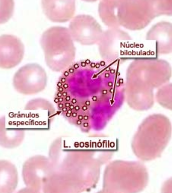 <p>TC Especial Sangre (<strong>Eosinófilos</strong>)</p><ul><li><p>Citoplasma ROJO</p></li><li><p>Núcleo con 2 lóbulos</p></li><li><p><em><u>Gránulos</u> </em>gruesos y toscos</p></li><li><p>Abundantes en recubrimeintos del aparato digestivo y respiratorio</p></li><li><p>AUMENTA EN</p><ul><li><p>Alergias (asma), fiebre, sensibilidad a alimentos y fármacos.</p></li><li><p>Protegen contra infecciones por gusanos</p></li></ul></li></ul><p></p>