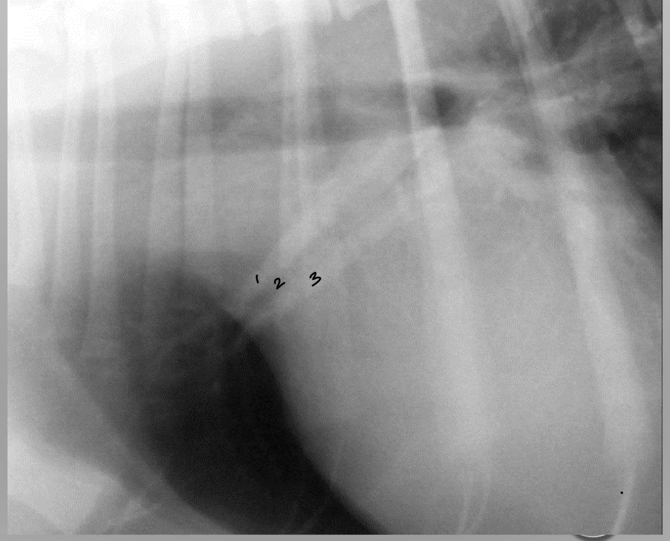 <p>identify the artery vein and bronchus</p>