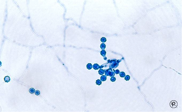 <p>short conidiophores with round, rough chains of conidia</p>