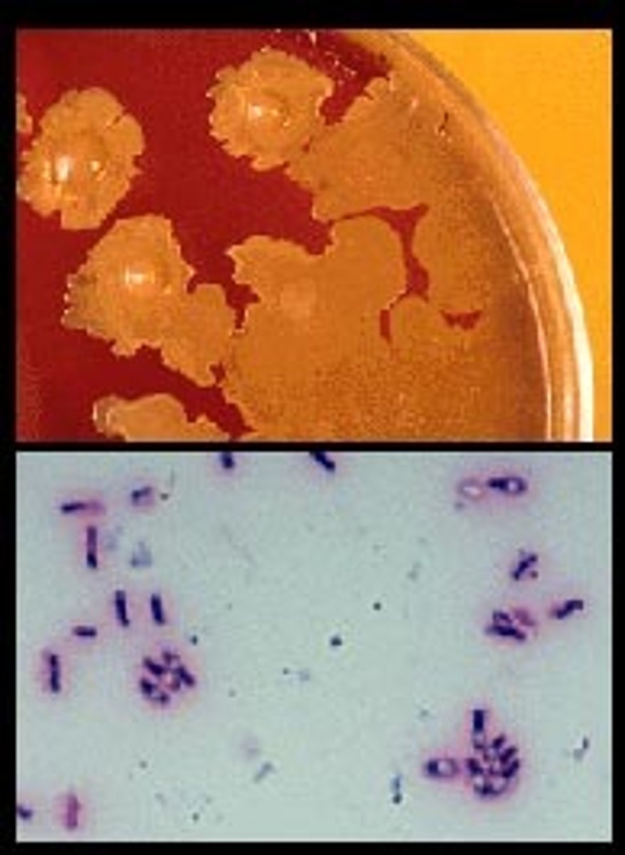 <p>The colonies seen in the upper frame, grown after 48 hours incubation aerobically at 35°C, and the accompanying gram stain in the lower frame are uncommonly associated with human disease, but have been associated with septicemia, bronchopneumonia, osteomyelitis and other infections, particularly in intravenous drug users. The most likely identification is:</p><p>A. Clostridium septicum</p><p>B. Bacillus circulans</p><p>C. Listeria monocytogenes</p><p>D. Lactobacillus species</p>