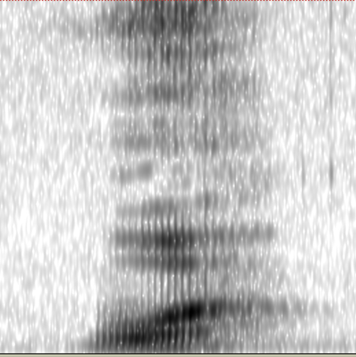 <p>Select the phoneme most likely depicted in the image below.</p>
