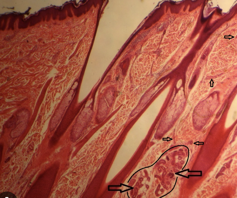 <p>Where the hair grows</p>