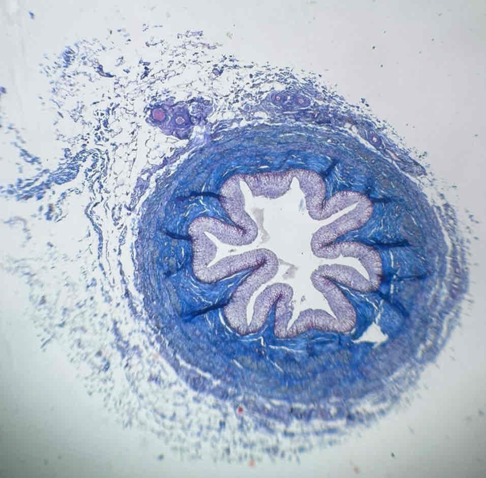 term image