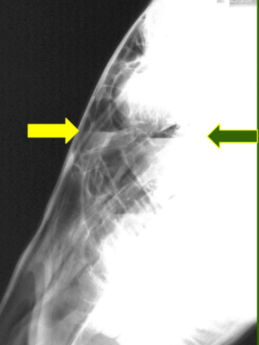<p>Identify the pathology</p>