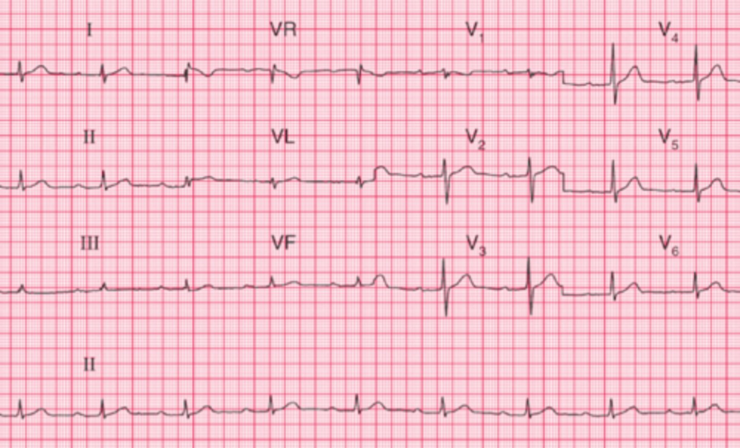 <p>What are the findings</p>