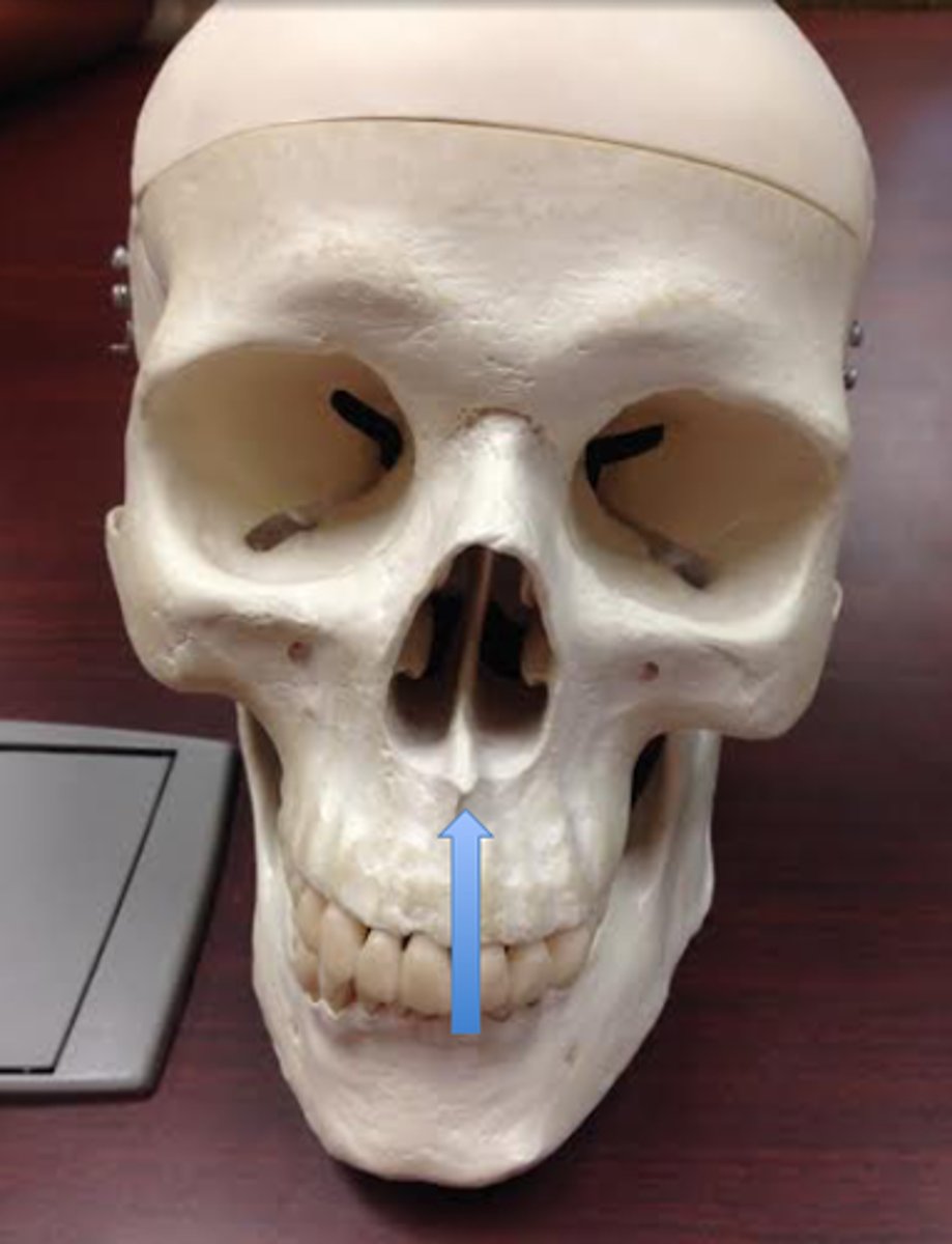 <p>What is shown on the image?</p>