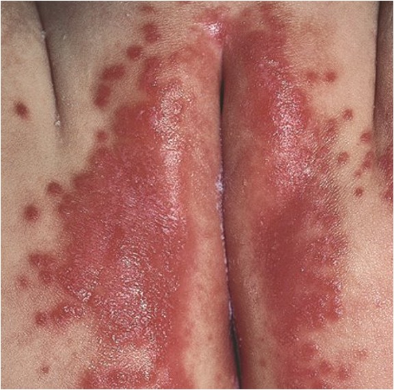 <p>what condition is this?</p>