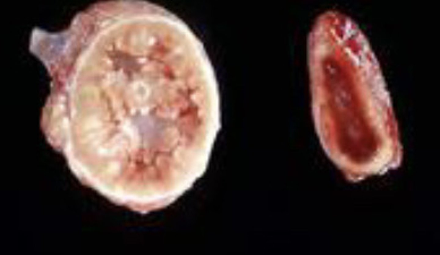 <p>These two adrenal glands are from the same dog? Which is abnormal?</p><p>A. Right is atrophic, left is normal</p><p>B. left is dysplastic, right is normal</p><p>C. left is hyperplastic, right is normal</p><p>D. left is hypertrophic, right is normal</p>