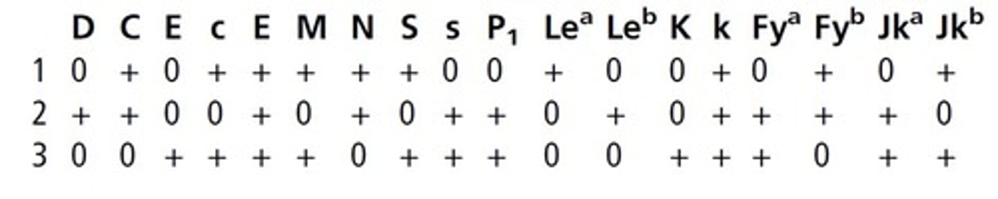 <p>a. Cell 1</p><p>M and N are antithetical alleles in the MNS system.</p><p>A cell with heterozygous expression of the</p><p>M antigen would therefore need to also express</p><p>the N antigen. In other words, it would need to</p><p>beM+N+. Cells that express onlyMor N antigen</p><p>(M+N or MN+) would be presumed to be</p><p>homozygous for either the M or N antigen,</p><p>respectively.</p>
