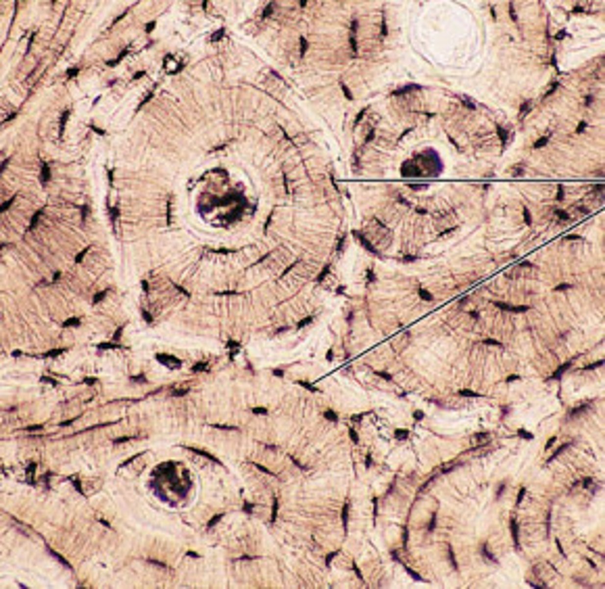 <p>Hard matrix; osteons with central canal; Cells: Osteocytes in lacunae; Function: Support, protection, mineral storage; Location: Skeleton (shaft of long bones).</p>