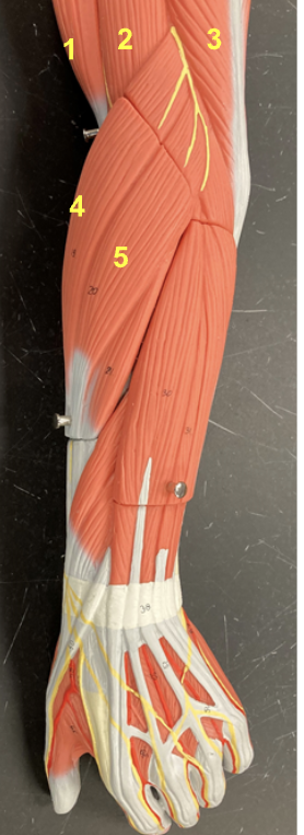 <p>Name the three major arm muscle you see on the posterior side of the forearm</p>