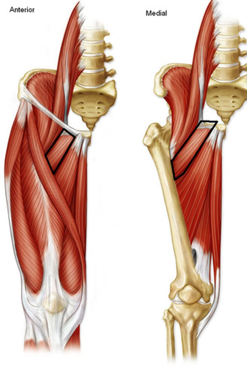 <p>Origin: pectineal line of pubis</p><p>Insertion: proximal linea aspera</p><p>Action: adducts and rotates hip</p>