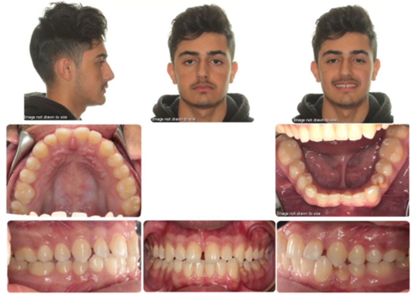 <p>Facial profile?</p>