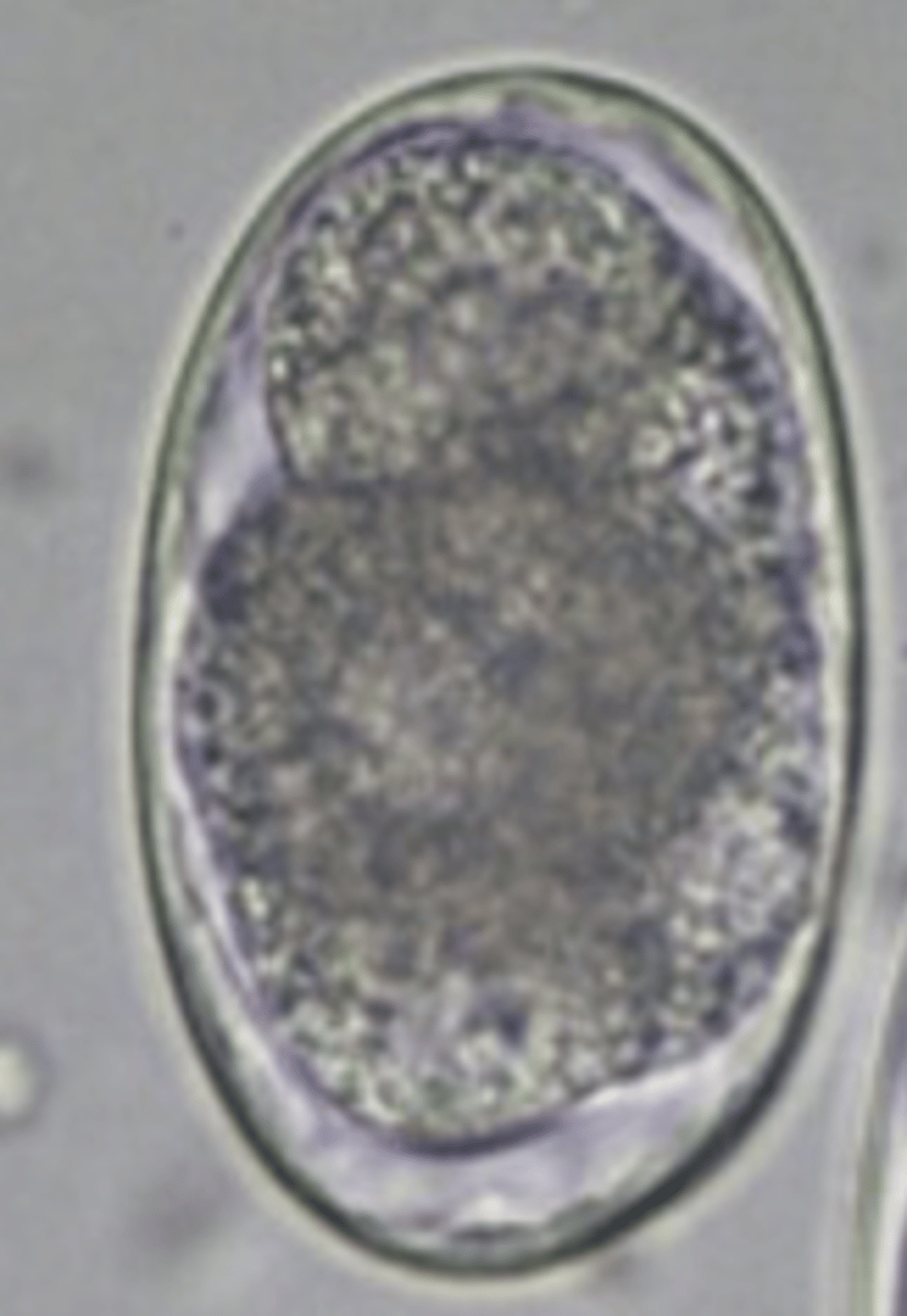 <p>Dog with weight loss, diarrhoea and anaemia. What parasite species does this egg belong to?</p>