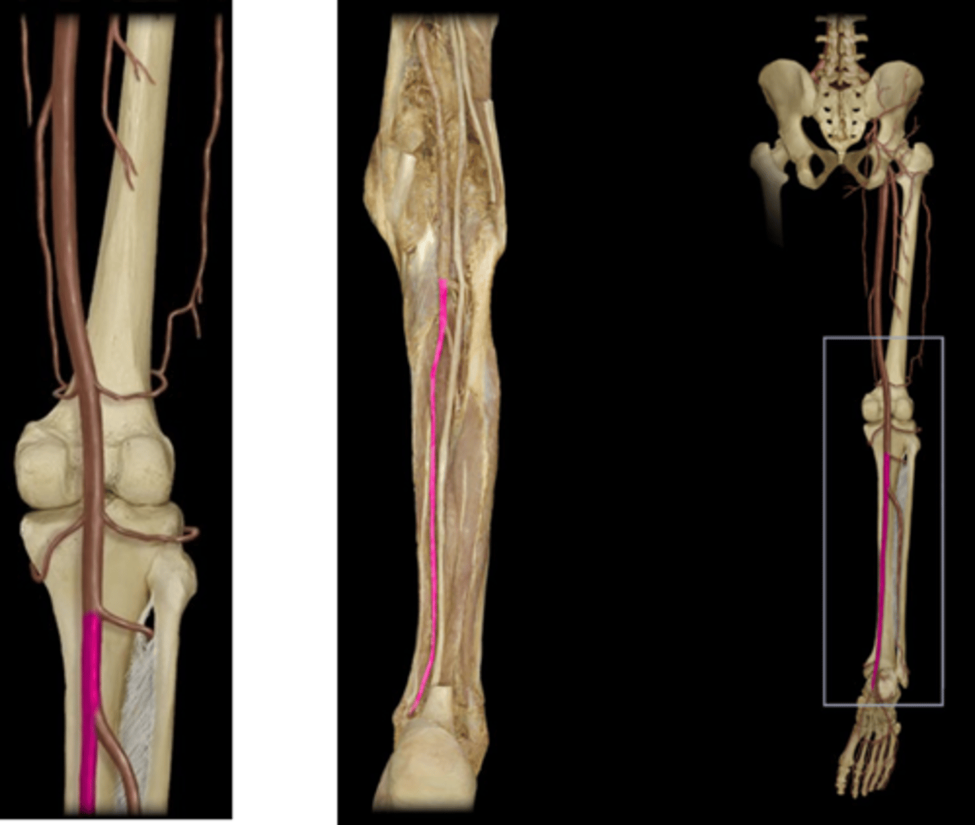 <p>Name this vessel.</p>