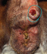 <p>Perianal adenoma </p>
