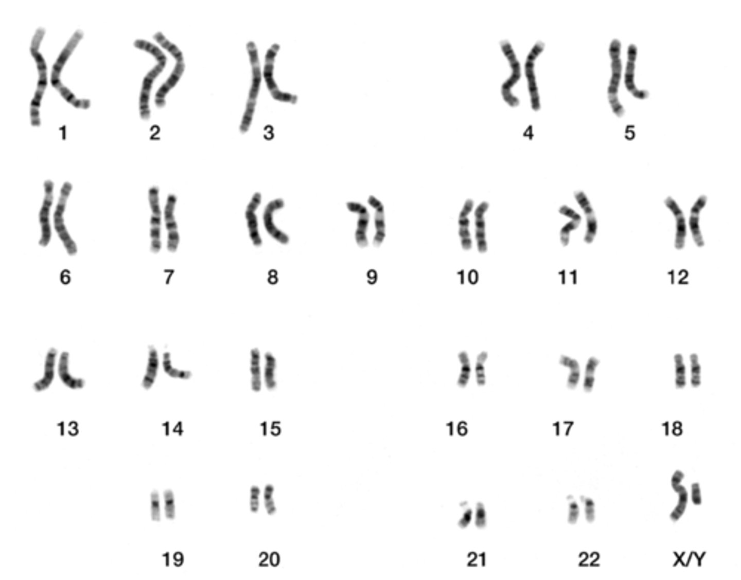 <p>karyotyping</p>