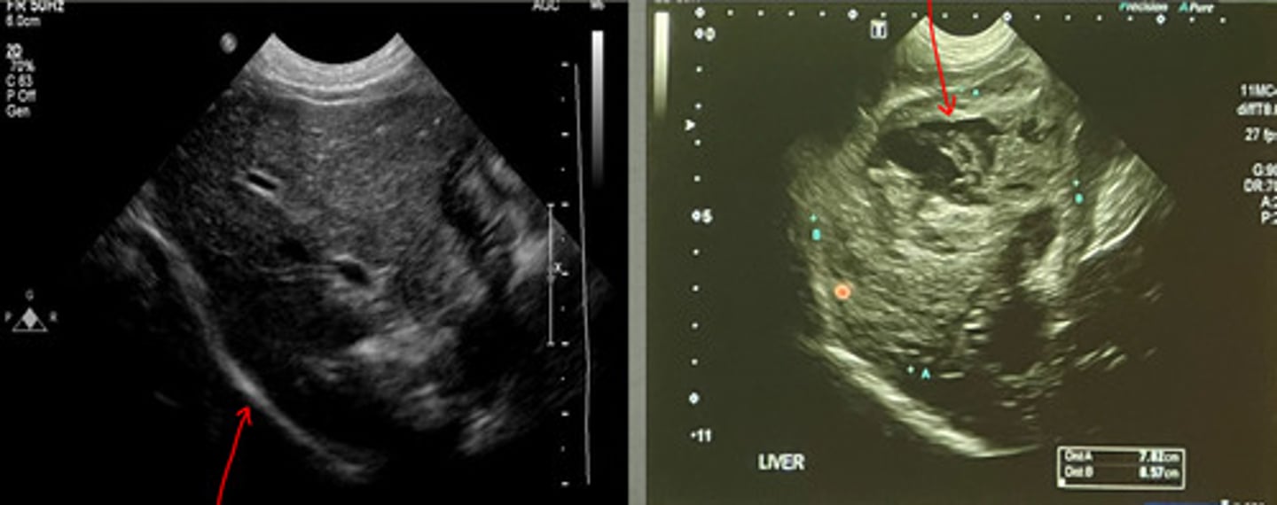 <p>what is the red arrow pointing to in the left image?</p>
