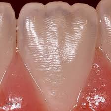 <p>wavy, transverse grooves on surface of tooth enamel</p>