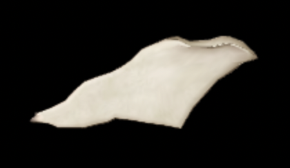 <p>Which bone is this?</p>