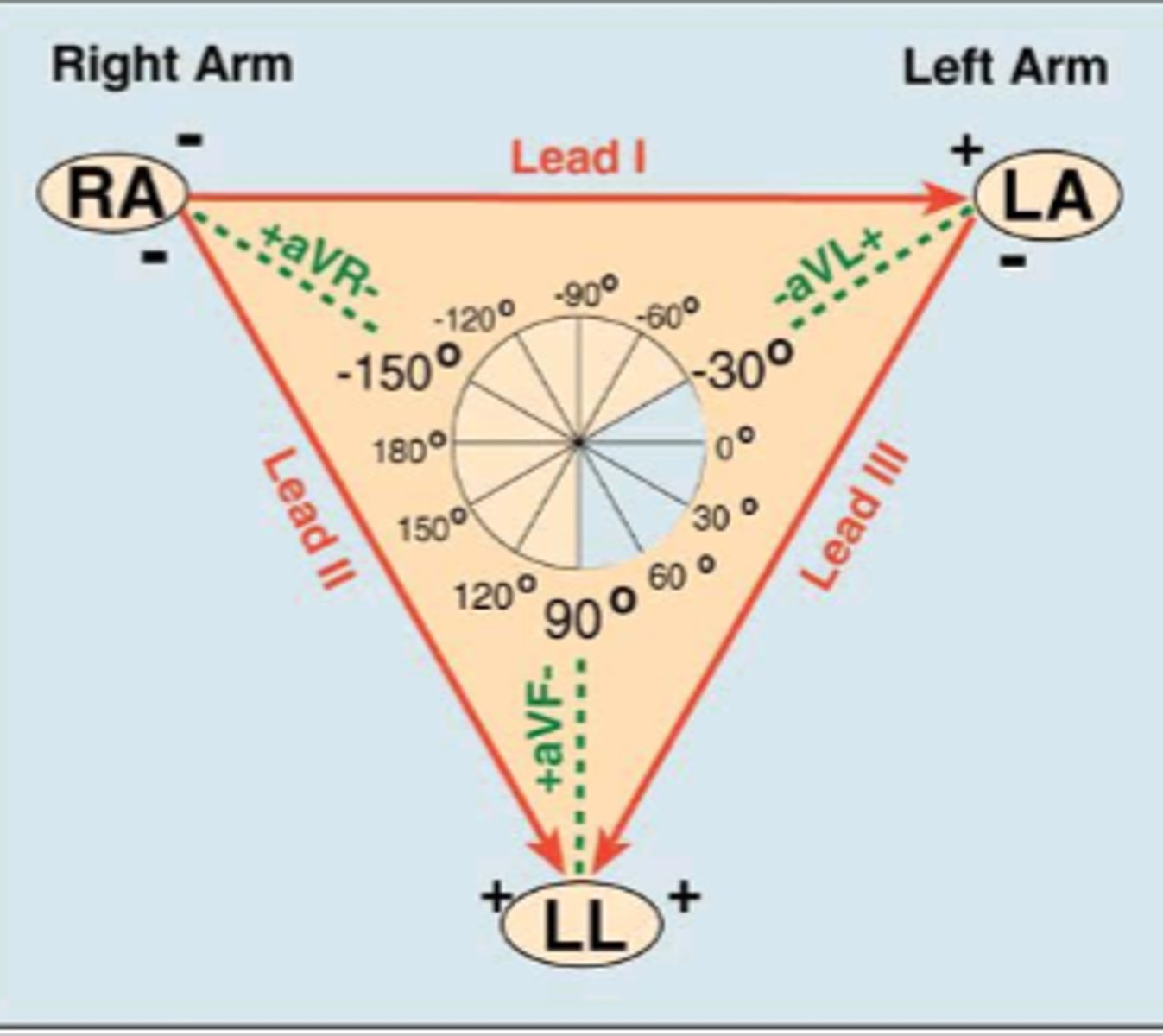 <p>Unipolar leads - augmented Voltage (aV)</p><p>aVR: right arm</p><p>aVL: left arm</p><p>aVF: left leg (foot)</p>