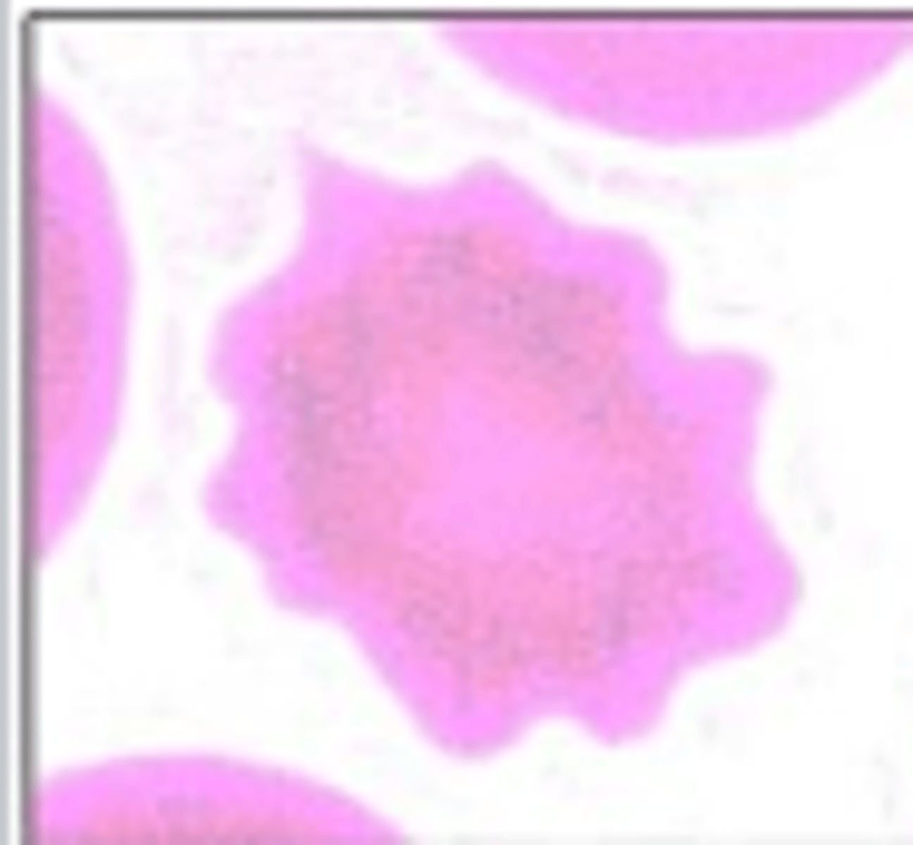 <p>What RBC morphology is this?</p>