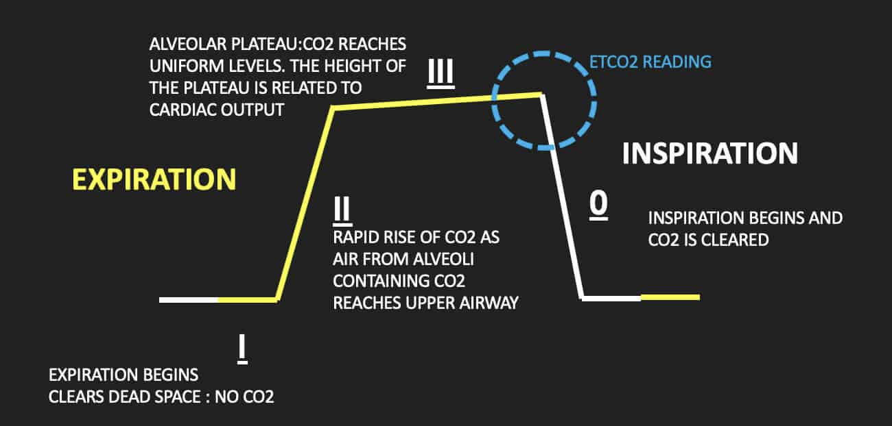 <p>ETCO2 = <strong>“End Tidal CO2”</strong></p><ul><li><p>Basically the max CO2 partial pressure before inhalation occurs </p></li><li><p>THIS is the value you’re reading during a capnograph - is at the end of the P<sub>A</sub>CO2 plateau of the graph</p></li></ul><p></p><p>ETCO2 should always land around 40</p><p></p>