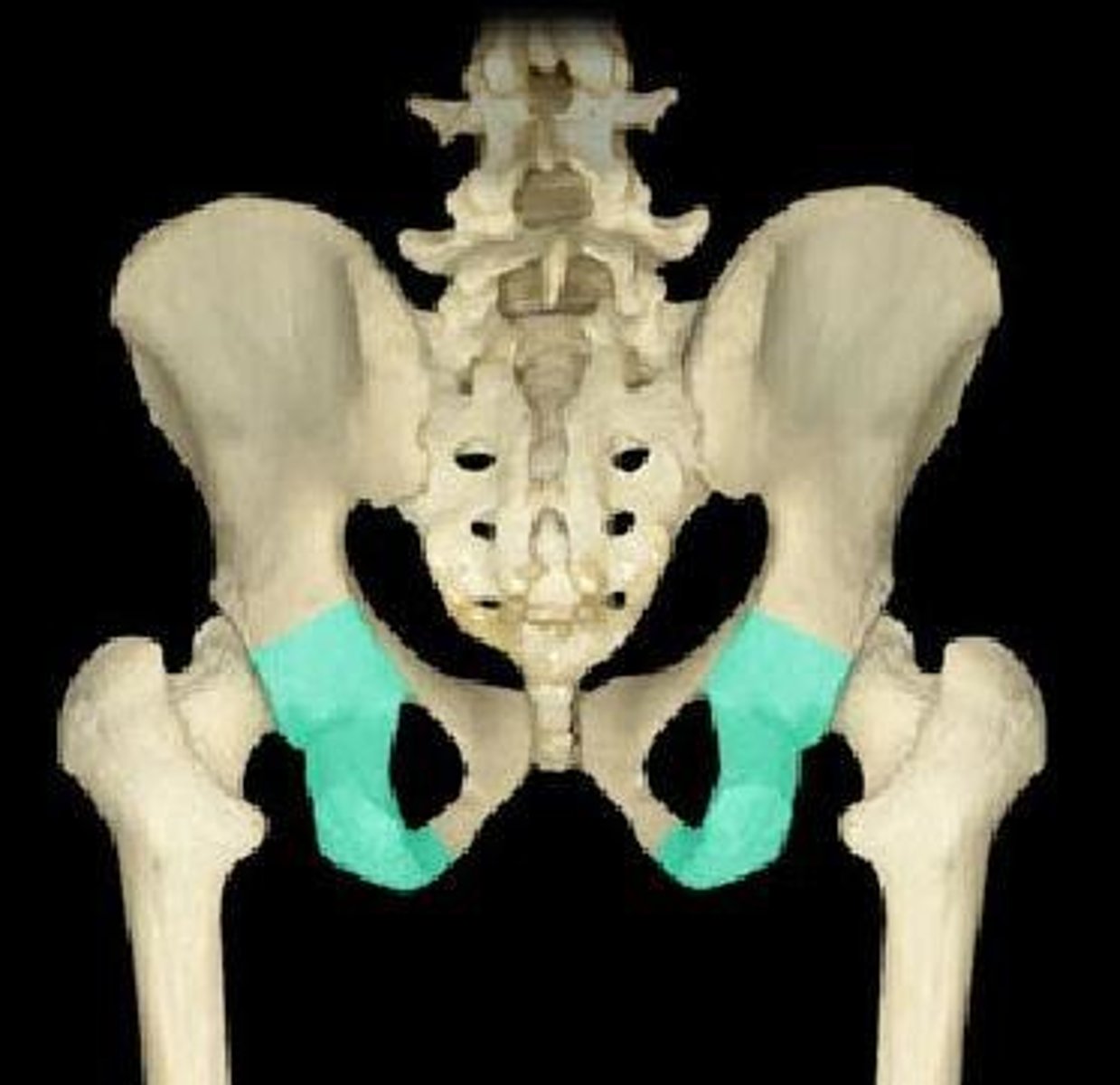 <p>Bottom of the ilium (anterior)</p>