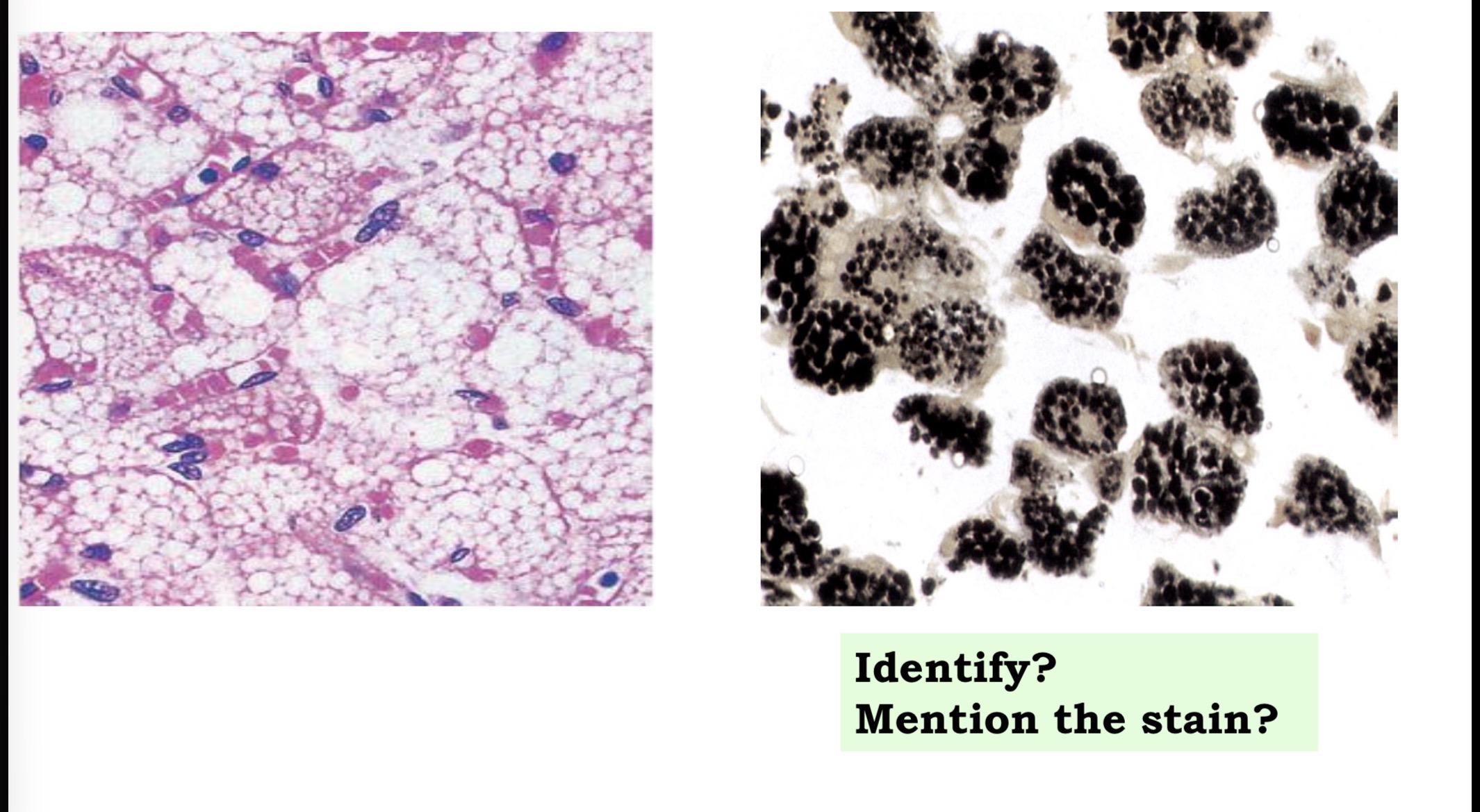 <p>Answer the questions in these following pictures</p>