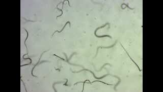 <p>Identify!!! They move in Thrashing motions.&nbsp;</p>