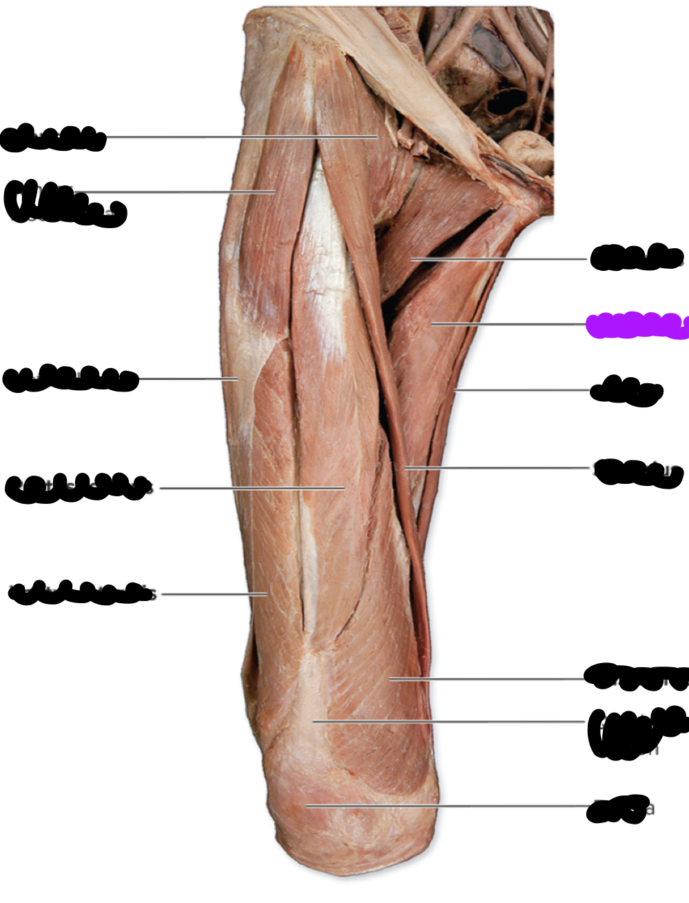 <p>Attachments?</p>
