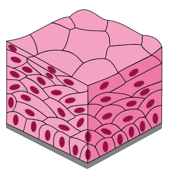 <p>What epithelial tissue is this and where is it found?</p>