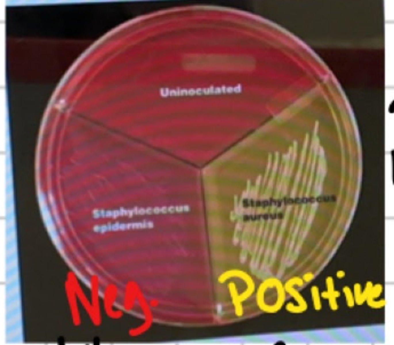 <p>Red AKA: "PHENOL RED", Stap E, Negative - Acid production</p><p>Yellow= "Coagulate"- Positive</p>