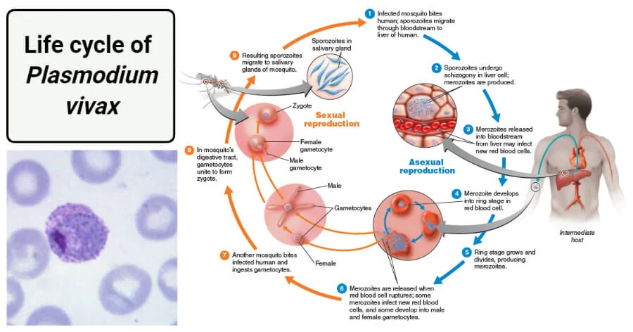 <p><strong>Plasmodium vivax</strong></p><p><strong>Apicomplexa</strong></p><p><strong>Aconoidasida</strong></p><p>colorless</p><p>Shape:&nbsp;</p><ul><li><p>Sporozoites: Lancet-shaped.</p></li><li><p>Trophozoites: Amoeboid, with an irregular, spreading cytoplasm.</p></li><li><p>Gametocytes: Round to oval shapes.</p></li></ul><p>Cell Arrangement: The parasites grow and reproduce inside red blood cells and liver cells.&nbsp;</p><p>Motility: The parasites are non-motile.&nbsp;</p><p>Found: transmitted by female Anopheles mosquitoes.&nbsp;</p><p>Disease: P. vivax causes malaria, a febrile illness characterized by fever, chills, headaches, and digestive issues.&nbsp;</p><p>Prevention:</p><ul><li><p>Mosquito control: Avoiding mosquito bites through the use of insect repellent and bed nets.&nbsp;</p></li><li><p>Antimalarial drugs: Chemoprophylaxis is used to prevent infection.&nbsp;</p></li></ul><p>Treatment:</p><ul><li><p>Blood stage treatment:</p><p>Chloroquine is the standard treatment for the symptomatic malaria parasite in the blood.&nbsp;</p></li><li><p>Liver stage treatment:</p><p>Primaquine is necessary to eradicate the dormant hypnozoite stage in the liver, which causes relapses.&nbsp;</p></li></ul><p>Life Cycle:</p><ol><li><p>Mosquito to human transmission:</p><p>An infected female Anopheles mosquito injects P. vivax sporozoites into a human host during a blood meal.&nbsp;</p></li><li><p>Liver stage (Exoerythrocytic phase):</p><p>Sporozoites migrate to the liver, where they multiply within liver cells (hepatocytes) and develop into liver-stage schizonts. Some may remain dormant as hypnozoites for long periods.&nbsp;</p></li><li><p>Merozoite release:</p><p>Rupturing schizonts release merozoites into the bloodstream.&nbsp;</p></li><li><p>Blood stage (Erythrocytic phase):</p><p>Merozoites infect red blood cells (specifically reticulocytes), where they develop into trophozoites, and then into schizonts.&nbsp;</p></li><li><p>Rupture and re-infection:</p><p>The schizonts rupture, releasing more merozoites to infect new red blood cells, repeating the cycle and causing symptoms.&nbsp;</p></li><li><p>Gametocyte formation:</p><p>Some parasites develop into gametocytes, which are then ingested by another mosquito during a blood meal.&nbsp;</p></li><li><p>Mosquito sexual reproduction:</p><p>Inside the mosquito, gametocytes undergo sexual reproduction to form sporozoites, which migrate to the salivary glands, completing the life cycle.&nbsp;</p></li></ol><p></p>