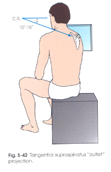 <ul><li><p>Patient rotated 45-60 degrees</p></li></ul><p></p>